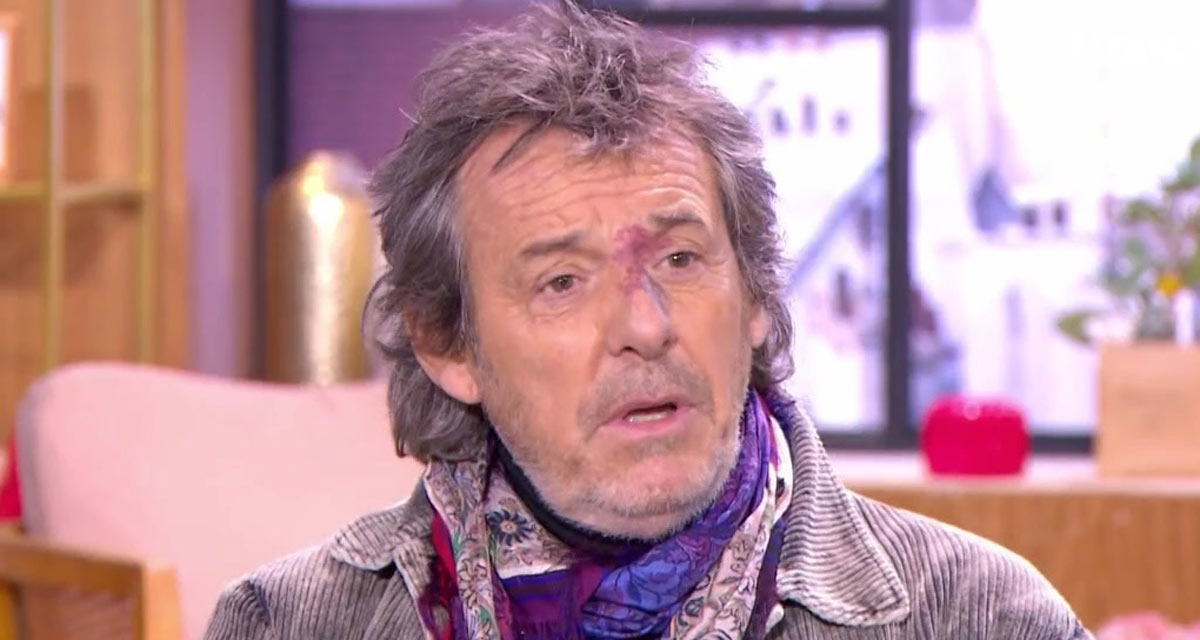 Jean-Luc Reichmann au bord des larmes en évoquant sa sœur handicapée Jean-Luc Reichmann au bord des larmes en évoquant sa sœur handicapée